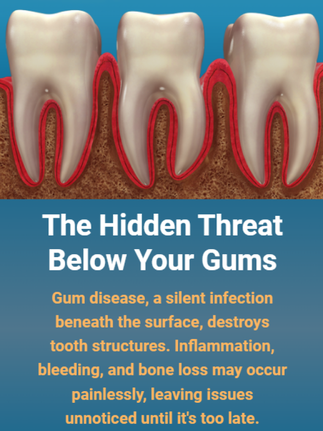 The Hidden Threat Below Your Gums